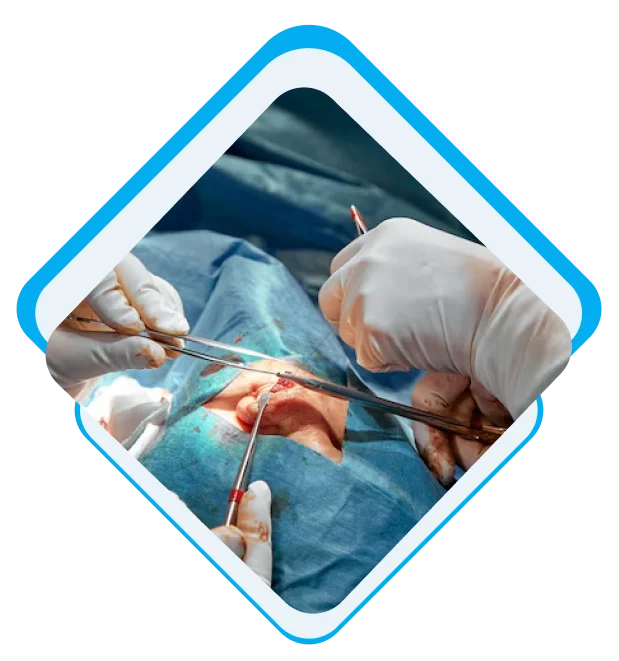 What Are the Most Common General Surgery Billing Errors